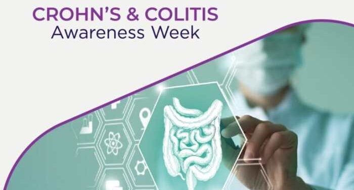 News and Features - Gastroenterology Advisor