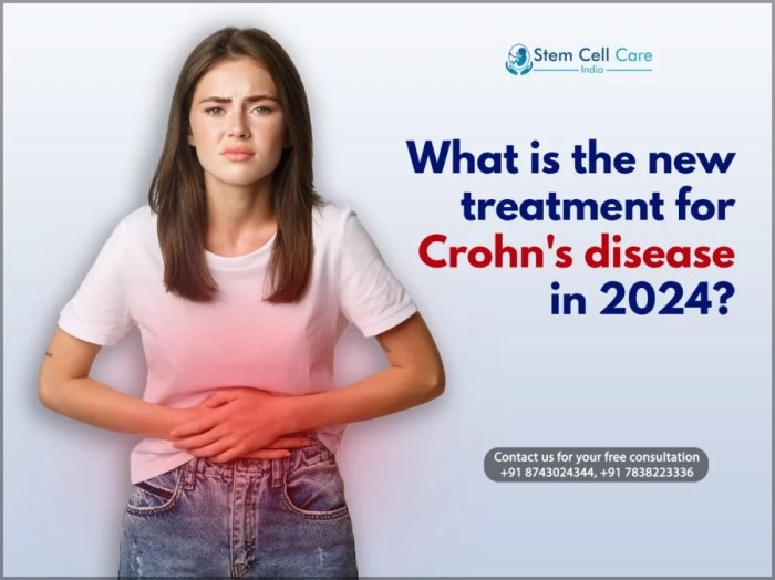 What Is the New Treatment for Crohn’s Disease in 2024?